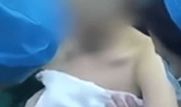 乳房视频,美丽与健康的双重守护